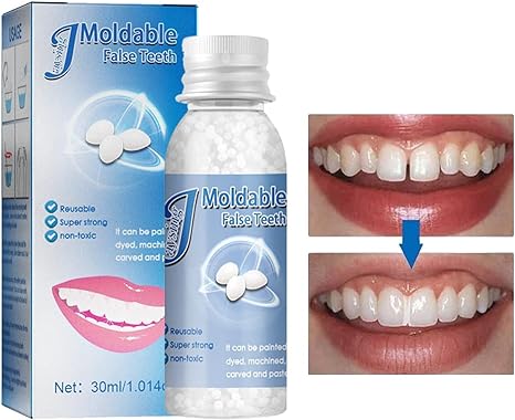 Dientes.Fix gránulos para reparación instantánea de dientes, 30ml